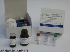 48t/96t 人细菌性阴道病(BV)ELISA试剂盒说明书