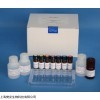 48T/96T 人甲状腺抗体（TAb）ELISA试剂盒实验原理