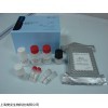 48T/96T  人甲状腺素抗体(TAb)ELISA试剂盒说明书
