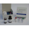 48T/96T 人白介素受體相關激酶(IRAK)ELISA試劑盒價格