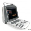 zoncare-V3 中旗zoncare-V3全数字彩色多普勒超声诊断仪
