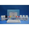 48T/96t 大鼠白介素1β (IL-1β)ELISA试剂盒用途