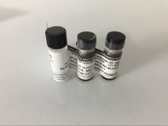 尿乙酰乙酸定性检测试剂盒