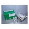 48t/96t 人抗核仁抗体(ANA)ELISA试剂盒
