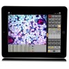 ScopePad-5000 iPad智能平板顯微鏡攝像儀